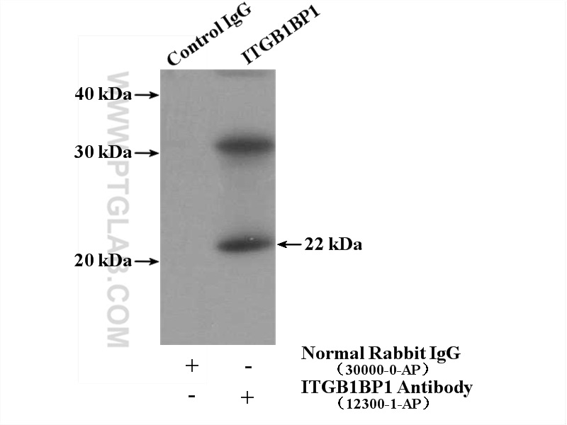 IP experiment of mouse thymus using 12300-1-AP