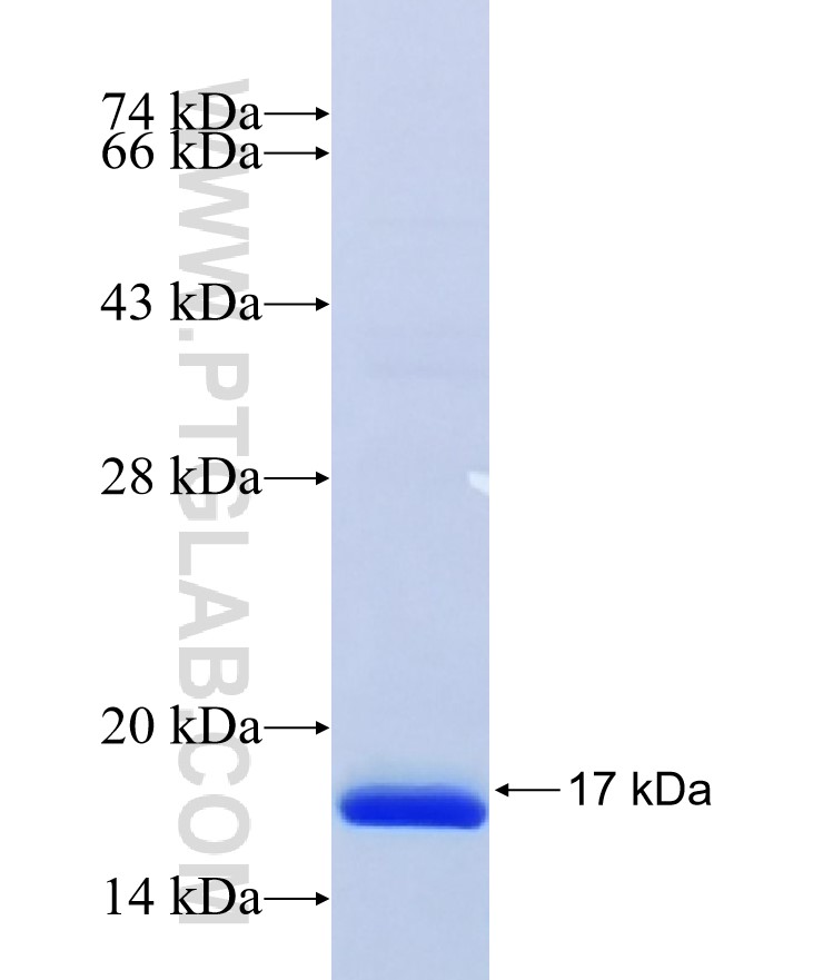 ITGB1BP3 fusion protein Ag26295 SDS-PAGE ITGB1BP3 fusion protein Ag26295 SDS-PAGE