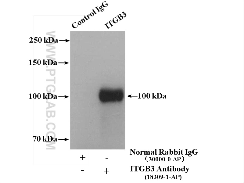 IP experiment of mouse spleen using 18309-1-AP