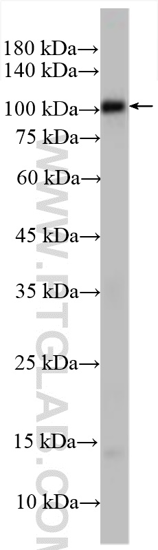 WB analysis of human peripheral blood platelets using 18309-1-AP