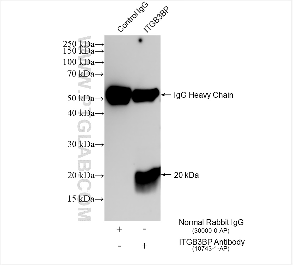 IP experiment of K-562 using 10743-1-AP