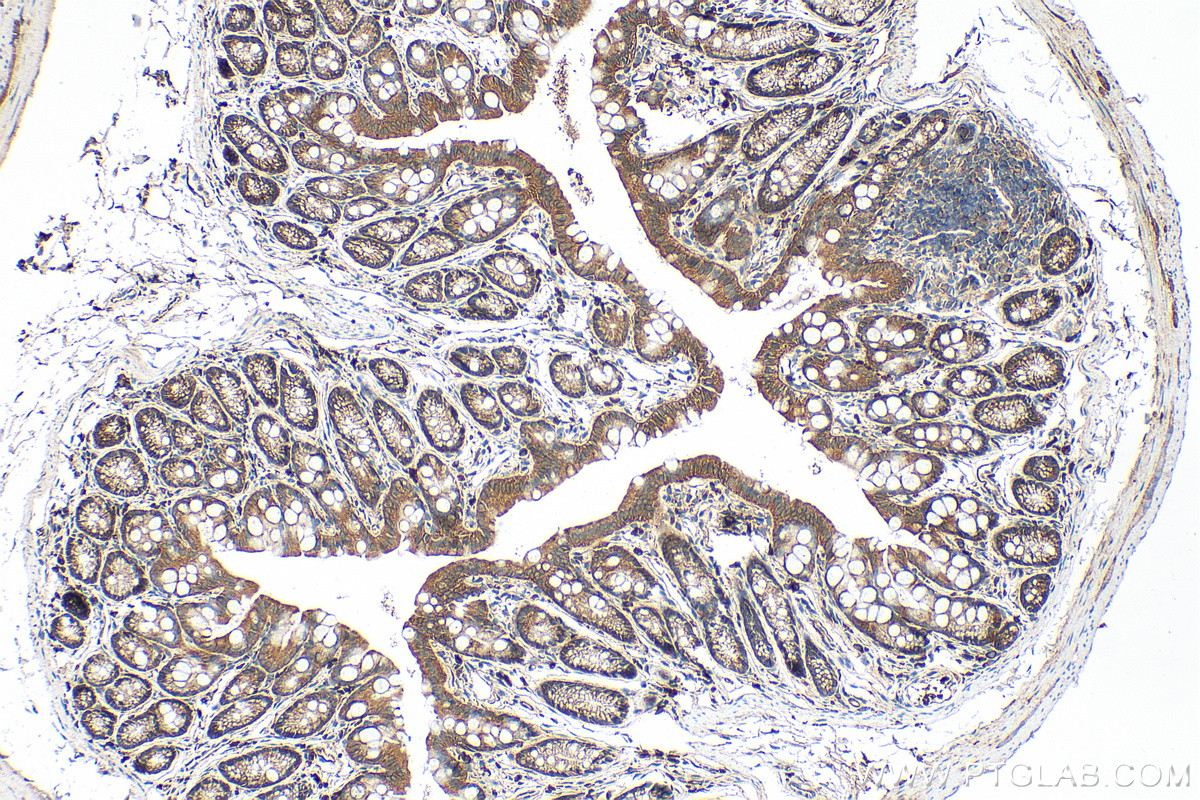 IHC staining of mouse colon using 21738-1-AP