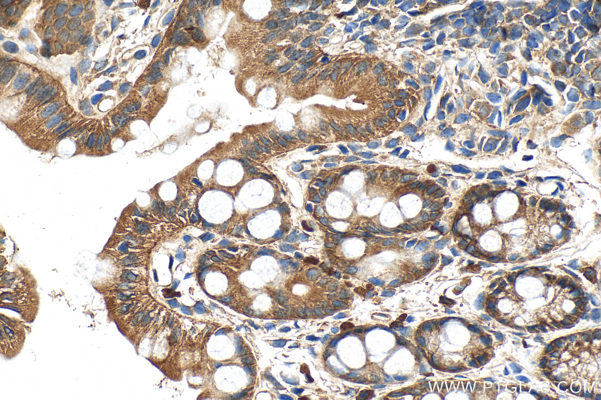 IHC staining of mouse colon using 21738-1-AP