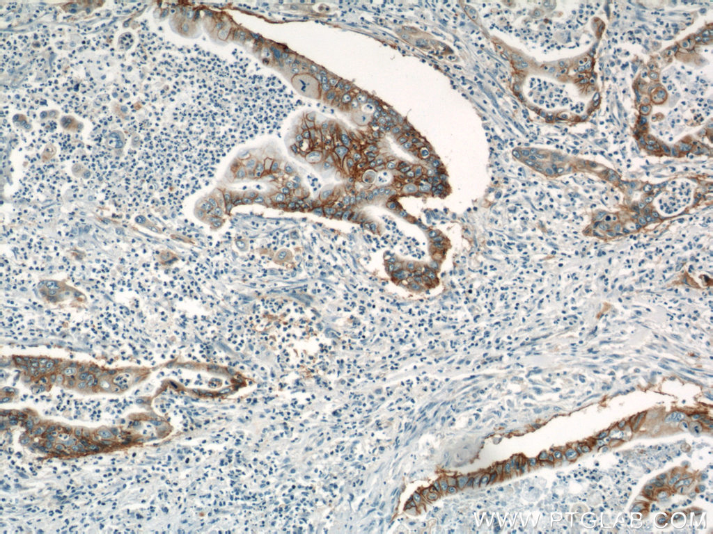 Integrin Beta 4 Polyclonal antibody