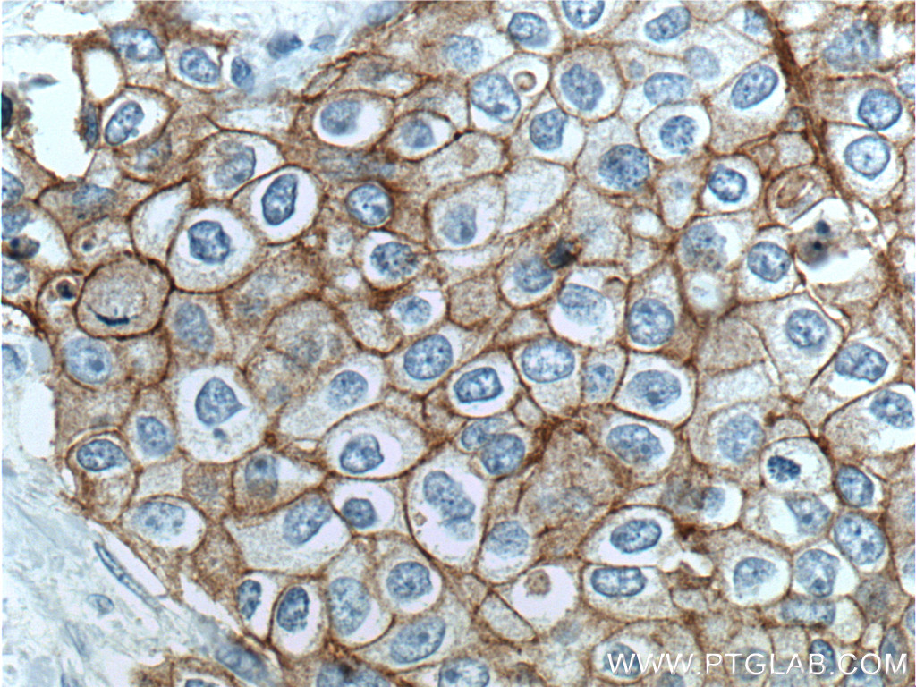 Integrin Beta 4 Polyclonal antibody