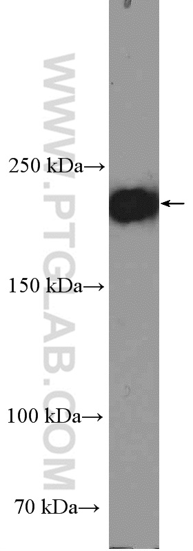 Integrin Beta 4 Polyclonal antibody