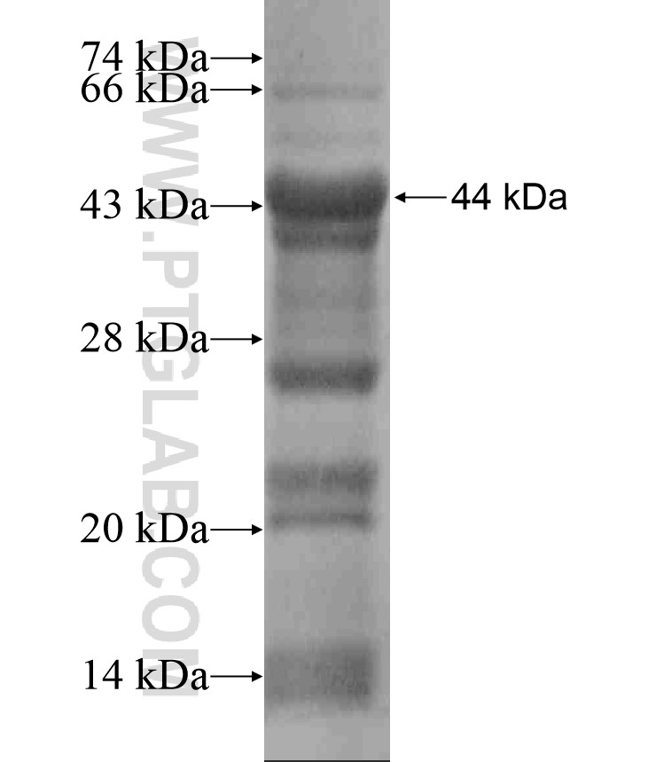 ITGB4 fusion protein Ag17396 SDS-PAGE ITGB4 fusion protein Ag17396 SDS-PAGE