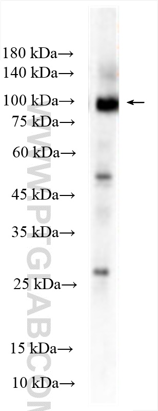 WB analysis of THP-1 using 11328-1-AP