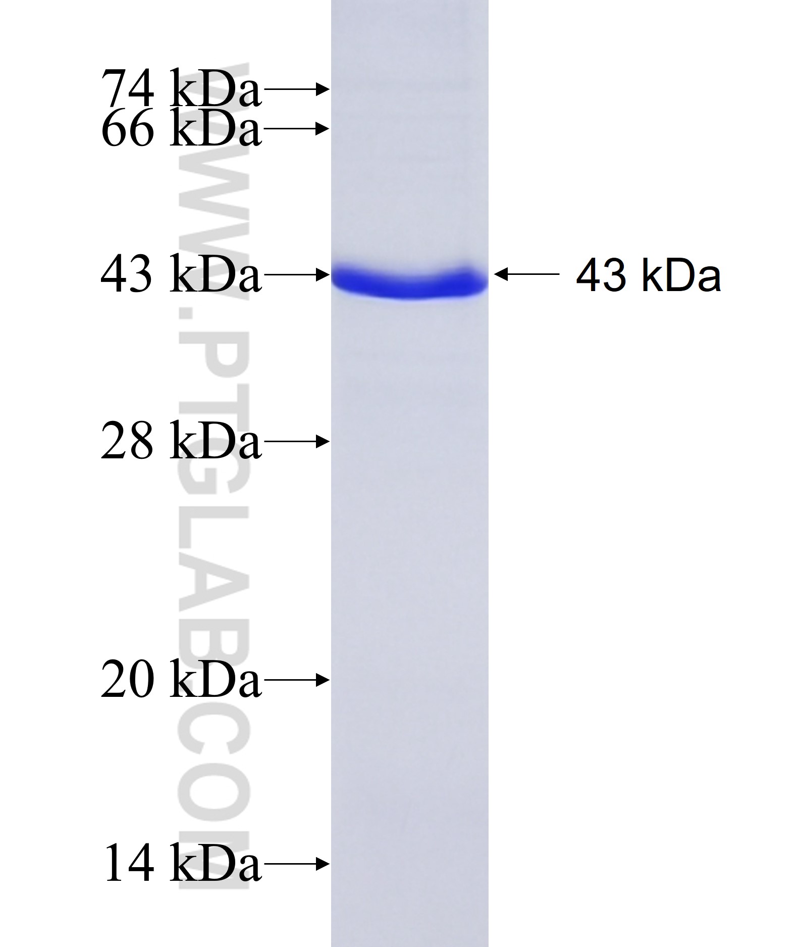 Integrin beta-8 fusion protein Ag7938 SDS-PAGE Integrin beta-8 fusion protein Ag7938 SDS-PAGE