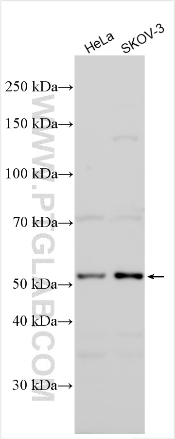 ITGBL1