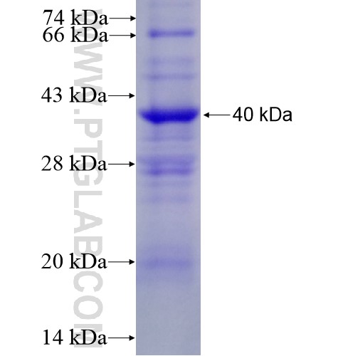 ITGBL1 fusion protein Ag11558 SDS-PAGE ITGBL1 fusion protein Ag11558 SDS-PAGE