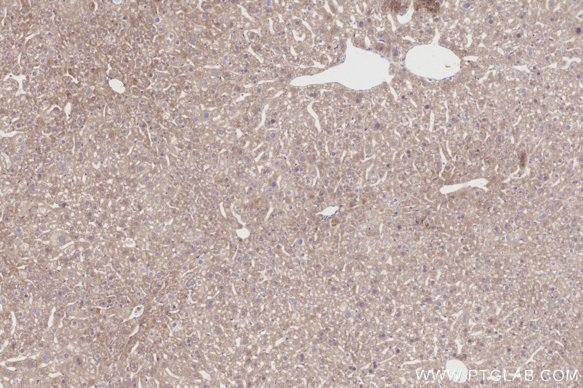 IHC staining of mouse liver using 21141-1-AP IHC staining of mouse liver using 21141-1-AP