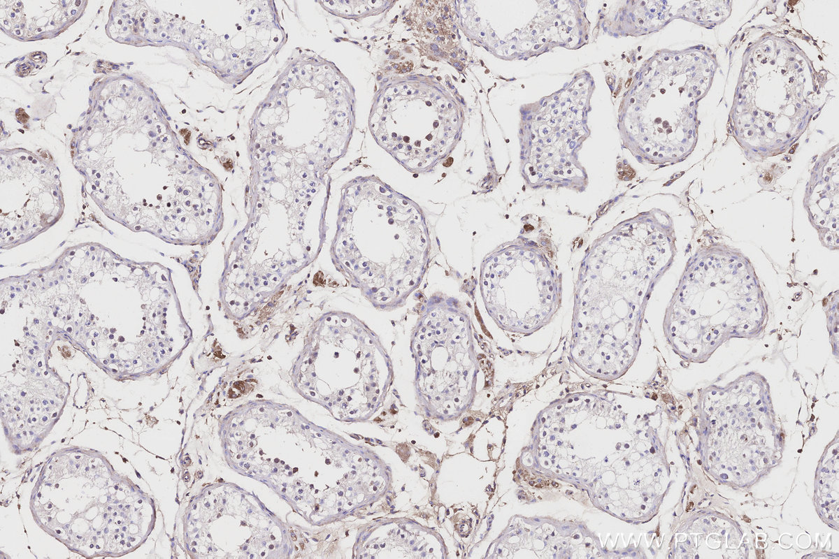 IHC staining of human testis using 21141-1-AP IHC staining of human testis using 21141-1-AP