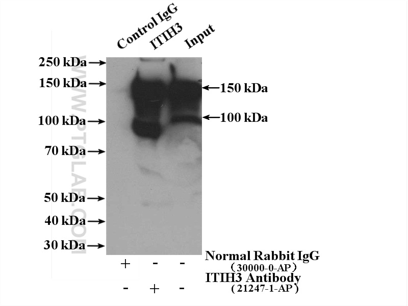 IP experiment of human plasma using 21247-1-AP (same clone as 21247-1-PBS)
