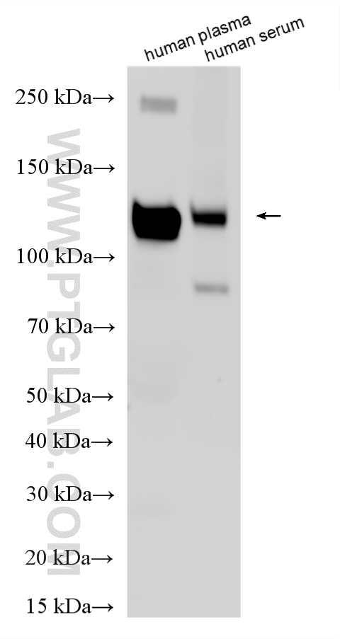 WB analysis using 21247-1-AP
