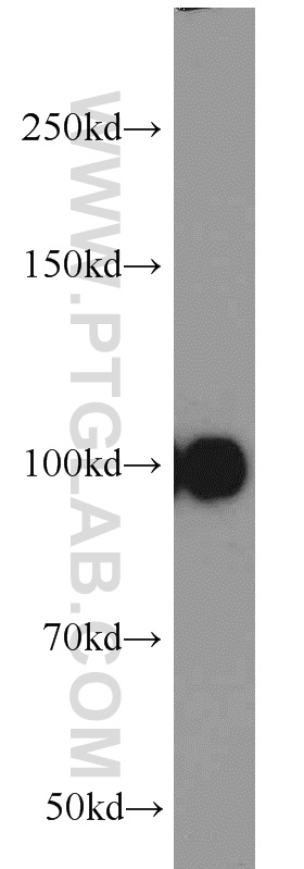 WB analysis of human plasma using 21247-1-AP (same clone as 21247-1-PBS)