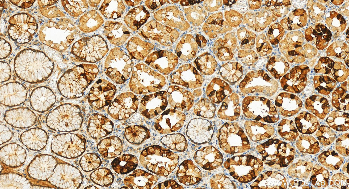 IHC staining of human stomach using 11770-1-AP