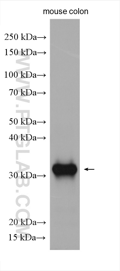 WB analysis of mouse colon using 11770-1-AP