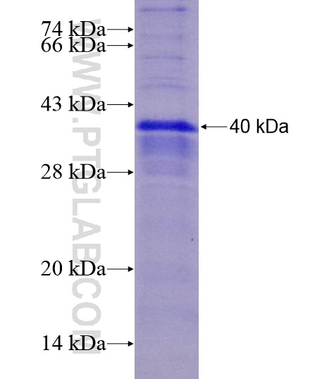 ITLN1 fusion protein Ag28617 SDS-PAGE