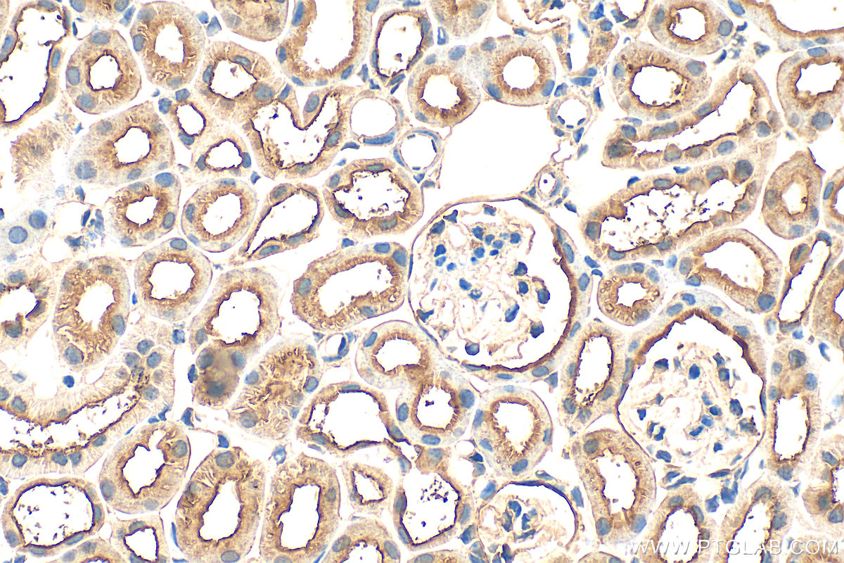 IHC staining of mouse kidney using 12193-1-AP