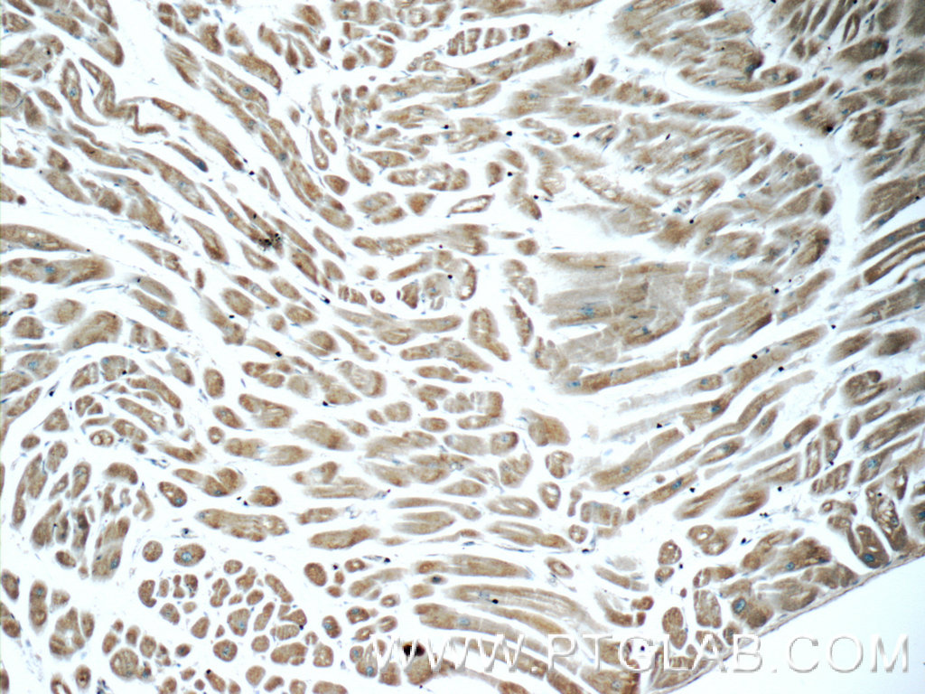 IHC staining of human heart using 16134-1-AP