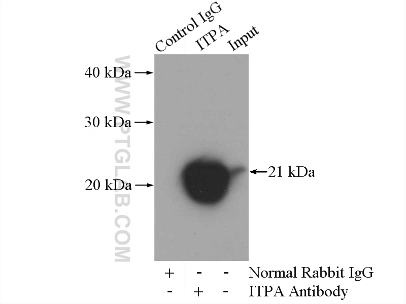 IP experiment of mouse liver using 16134-1-AP
