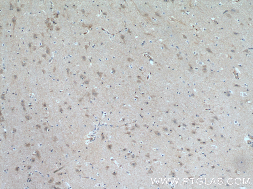 IHC staining of human brain using 10568-1-AP