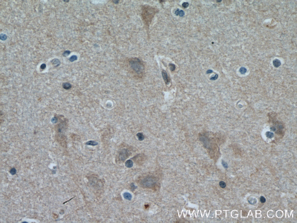 IHC staining of human brain using 10568-1-AP