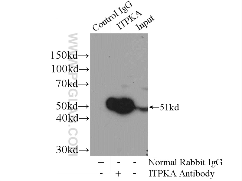 IP experiment of mouse brain using 14270-1-AP