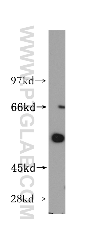 WB analysis of mouse brain using 14270-1-AP