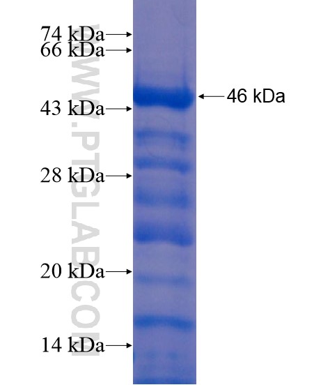 ITPKB fusion protein Ag21362 SDS-PAGE