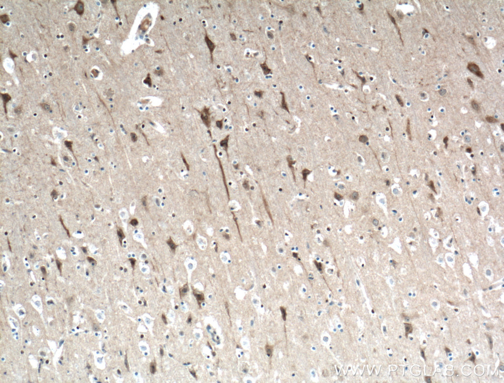 IHC staining of human brain using 19962-1-AP