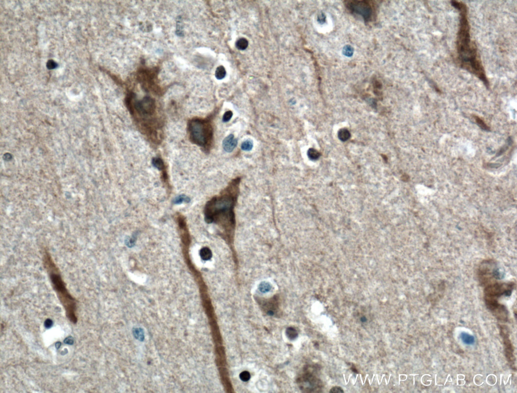 IHC staining of human brain using 19962-1-AP