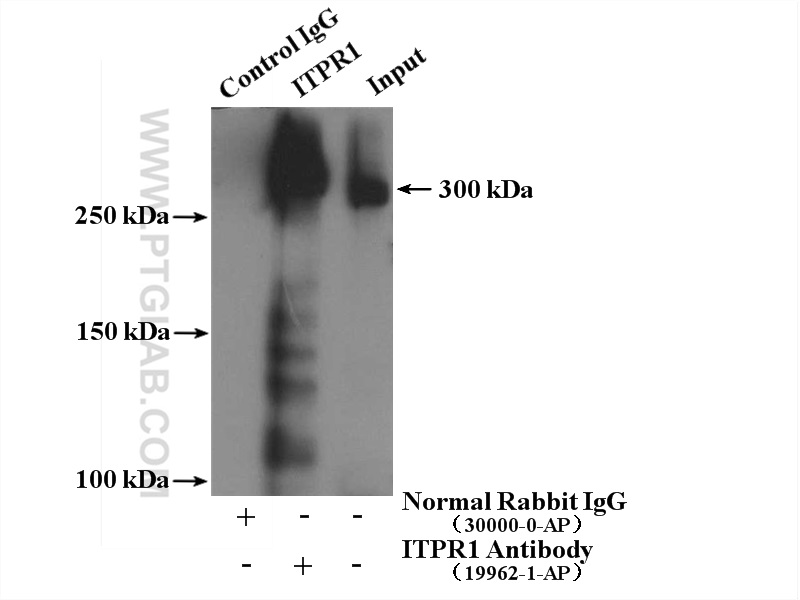 IP experiment of mouse brain using 19962-1-AP