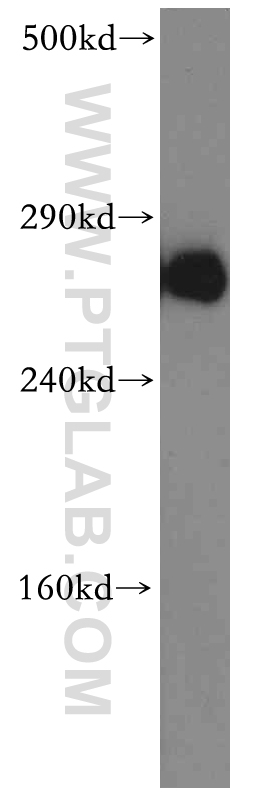 WB analysis of mouse brain using 19962-1-AP