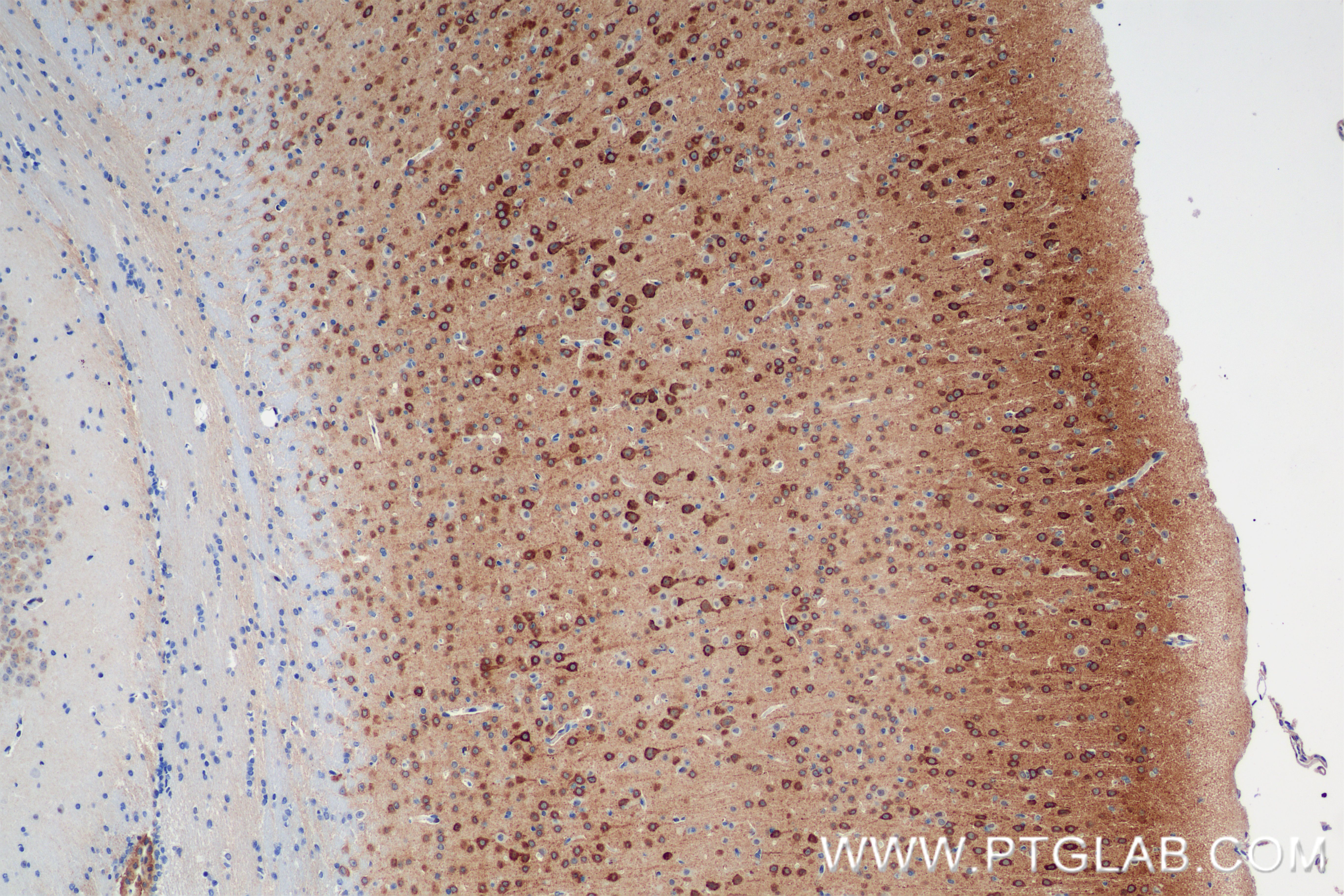 Immunohistochemical analysis of paraffin-embedded mouse brain tissue slide using 85101-1-RR (ITPR1-Specific antibody) at dilution of 1:400 (under 10x lens). Heat mediated antigen retrieval with Tris-EDTA buffer (pH 9.0). IHC staining of mouse brain using 85101-1-RR