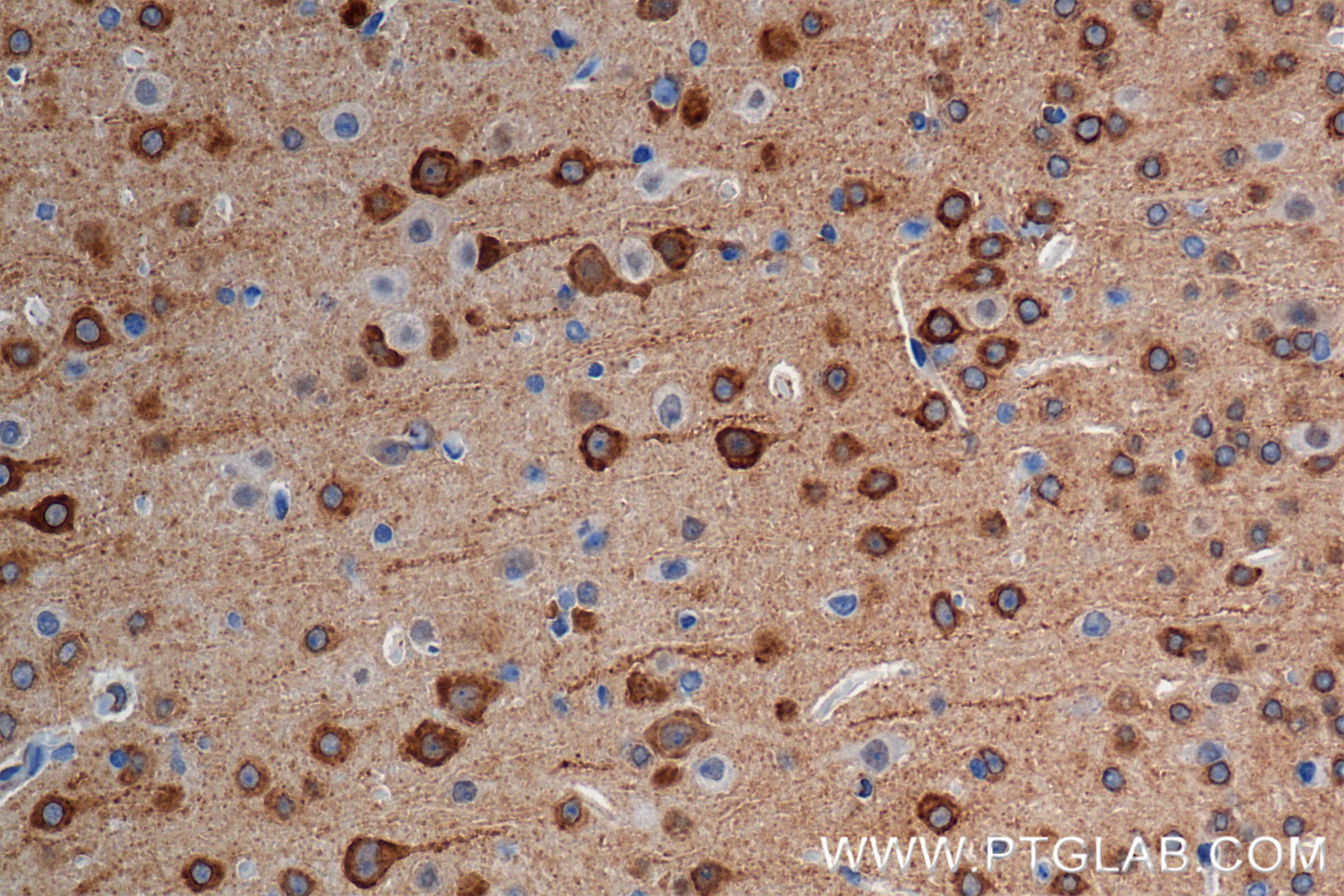 Immunohistochemical analysis of paraffin-embedded mouse brain tissue slide using 85101-1-RR (ITPR1-Specific antibody) at dilution of 1:400 (under 40x lens). Heat mediated antigen retrieval with Tris-EDTA buffer (pH 9.0). IHC staining of mouse brain using 85101-1-RR