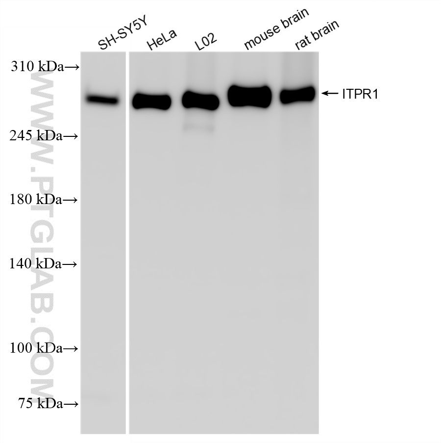 Various lysates were subjected to SDS PAGE followed by western blot with 85101-1-RR (ITPR1-specific antibody) at dilution of 1:10000 incubated at room temperature for 1.5 hours. WB analysis using 85101-1-RR