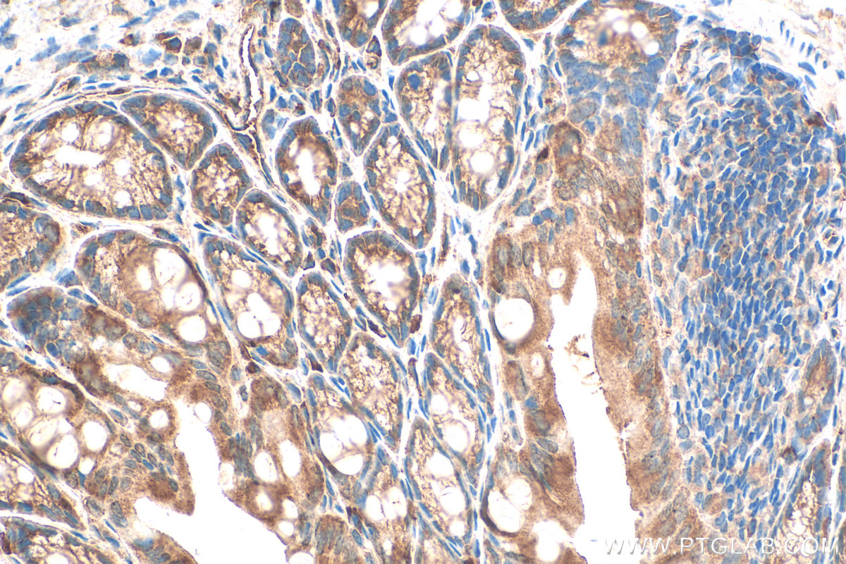 IHC staining of mouse colon using 20729-1-AP