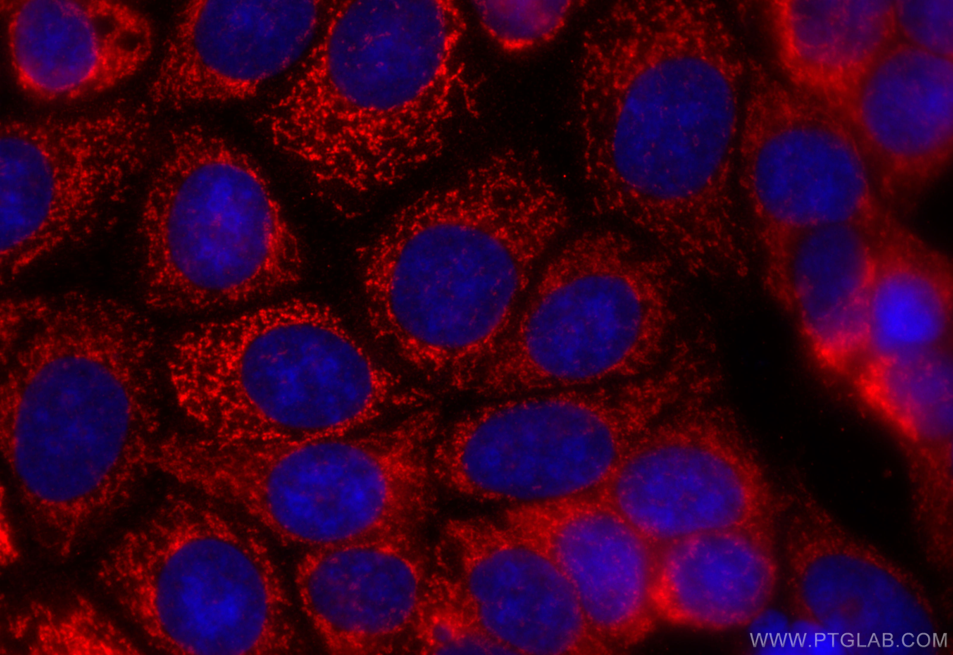 IF Staining of MCF-7 using 10822-1-AP