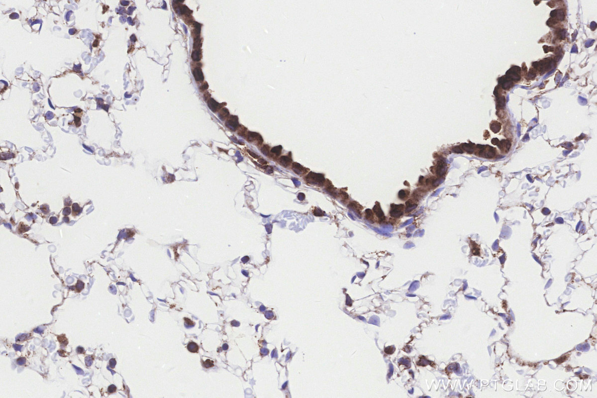 IHC staining of mouse lung using 66032-1-Ig IHC staining of mouse lung using 66032-1-Ig