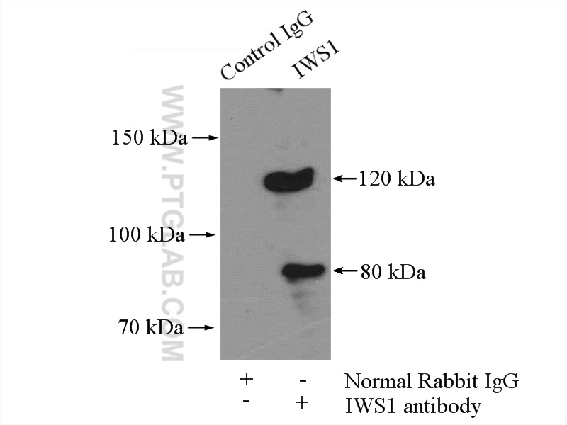 IP experiment of mouse brain using 16943-1-AP