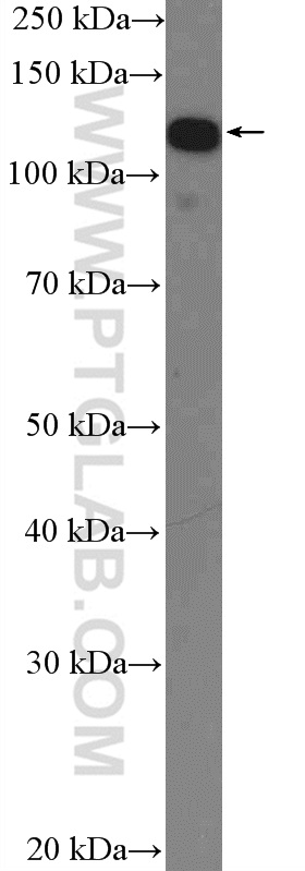 WB analysis of HeLa using 16943-1-AP