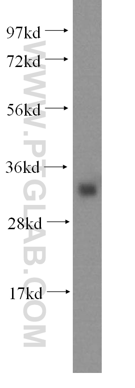 WB analysis of human liver using 16667-1-AP