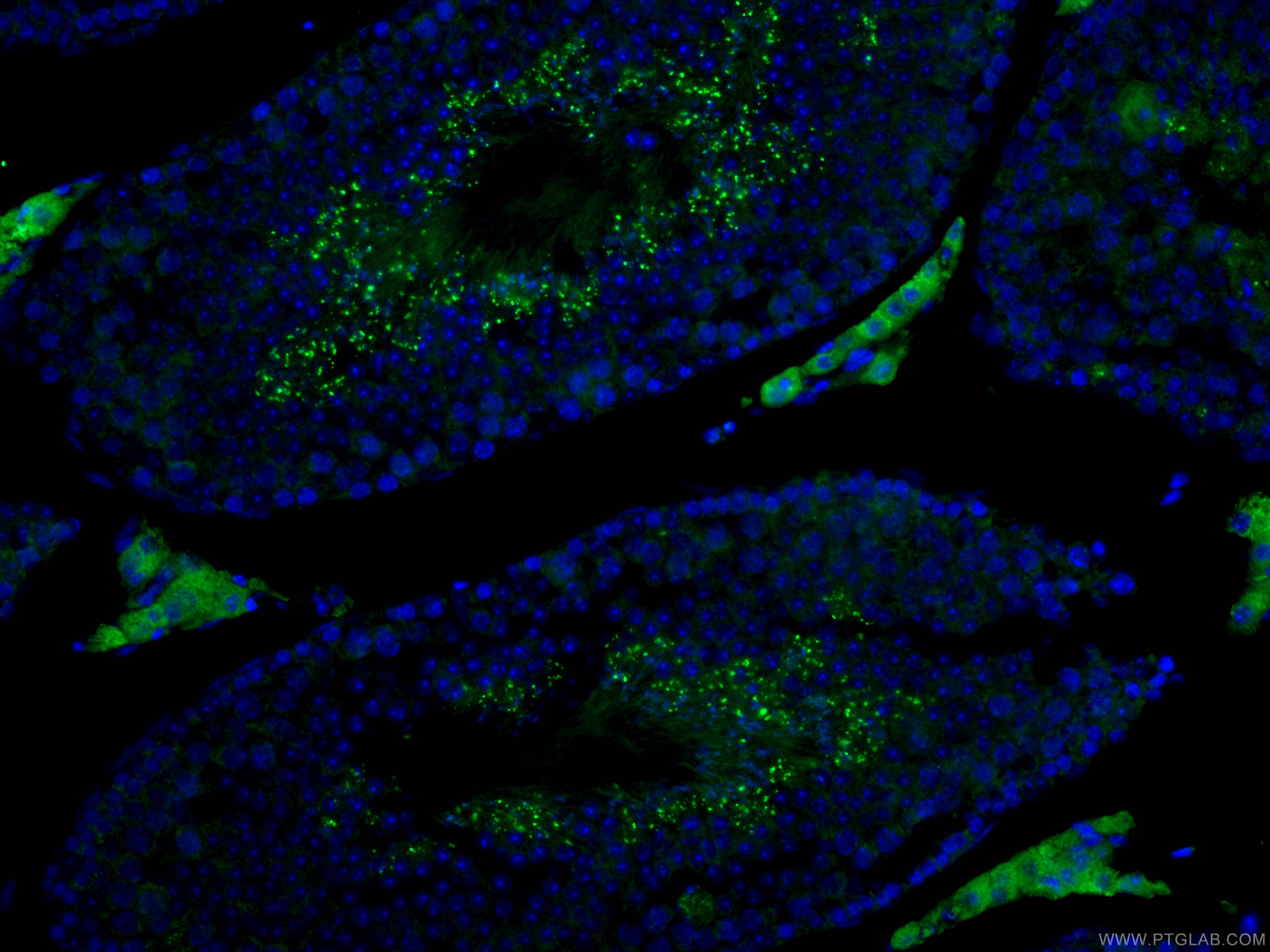 IF Staining of mouse testis using 13296-1-AP
