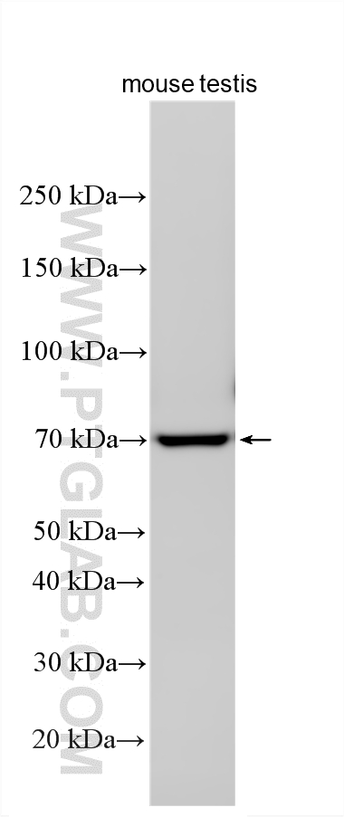 Mouse testis tissue were subjected to SDS PAGE followed by western blot with 13296-1-AP (IZUMO1 antibody) at dilution of 1:500 incubated at room temperature for 1.5 hours. WB analysis using 13296-1-AP
