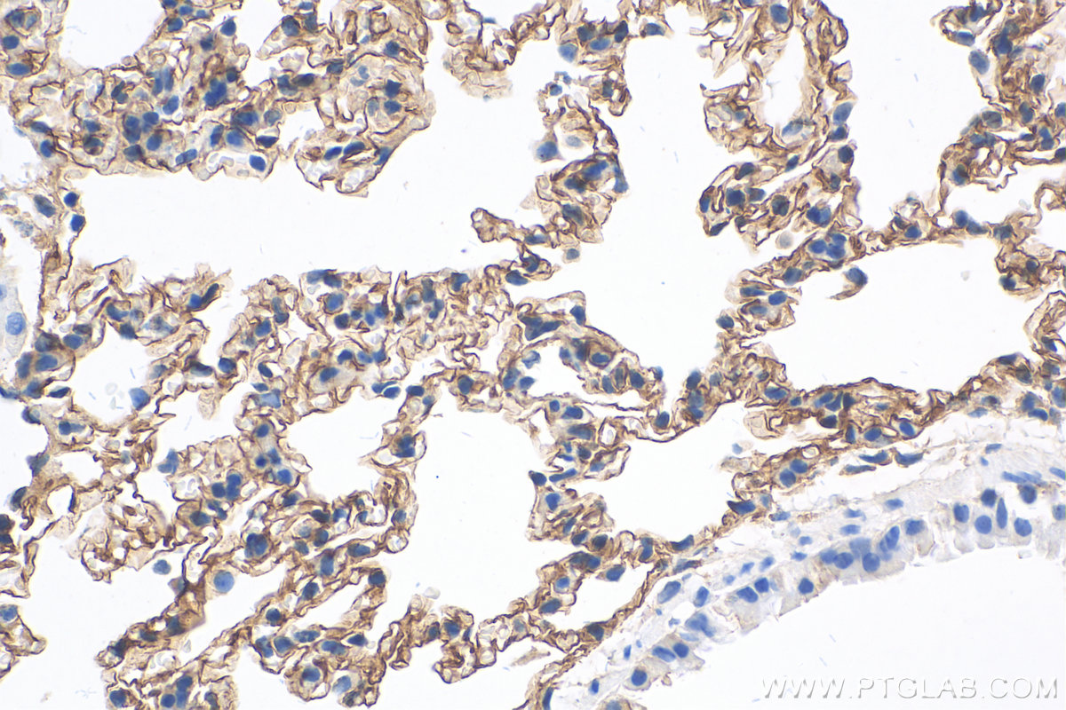 IHC staining of mouse lung using 10020-1-AP