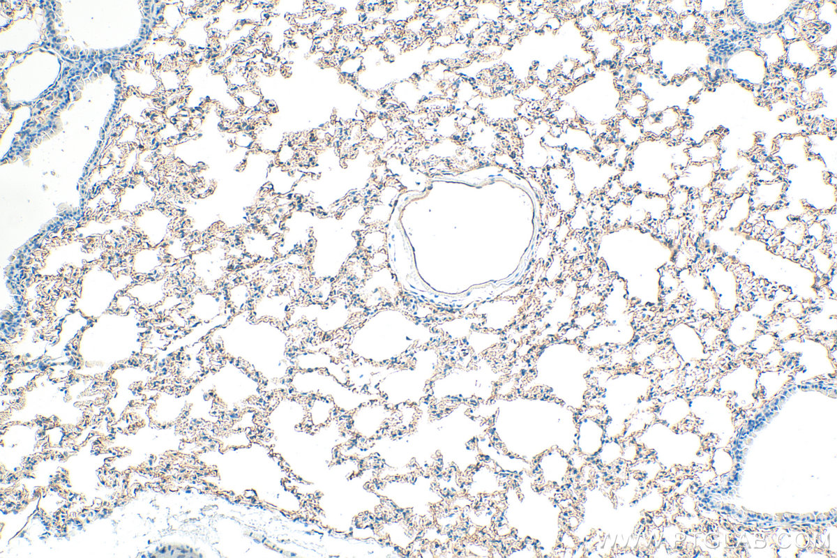 IHC staining of mouse lung using 10020-1-AP IHC staining of mouse lung using 10020-1-AP