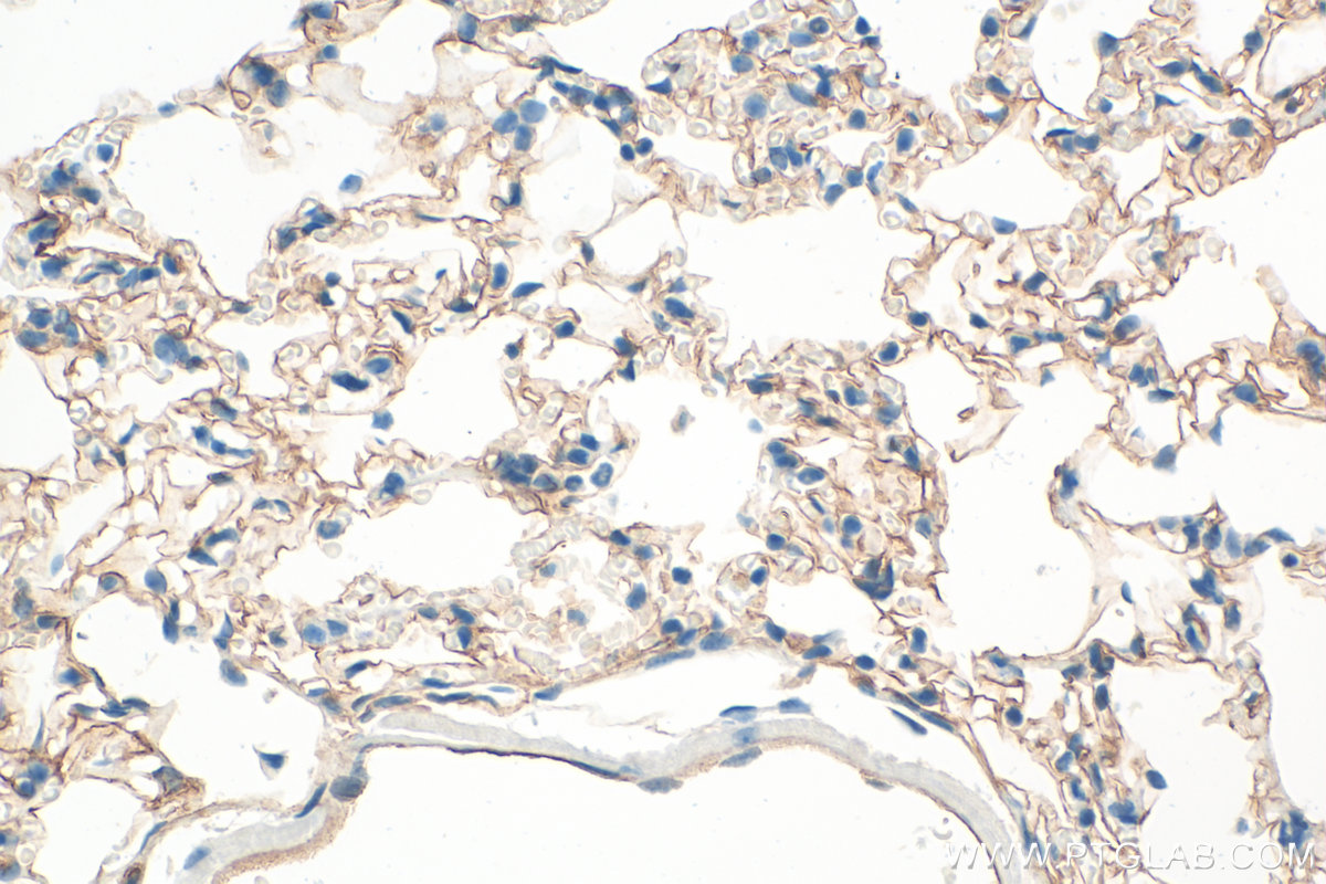 IHC staining of mouse lung using 10020-1-AP IHC staining of mouse lung using 10020-1-AP