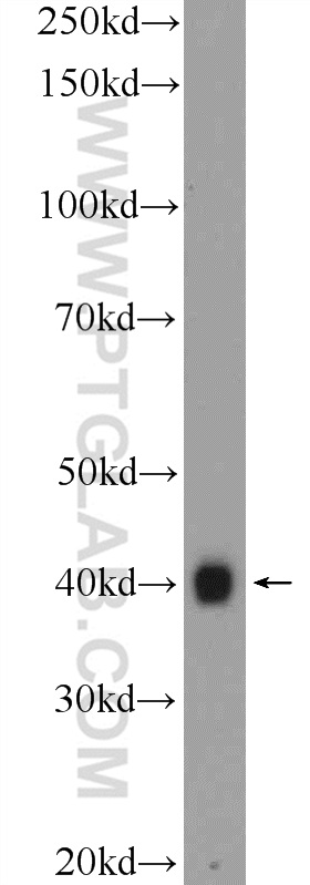 WB analysis of HEK-293 using 25964-1-AP